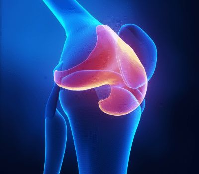Cartilage tear - meniscus injury