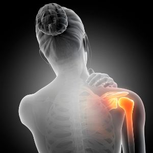 Signs and Symptoms of a Dislocated Shoulder